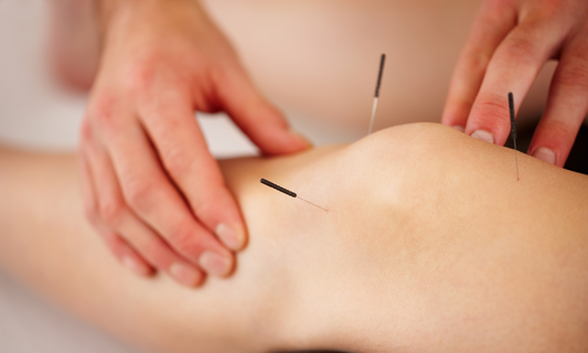 Acupuncture and Women’s Health