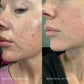 White Willow Purifying Cleansing Gel