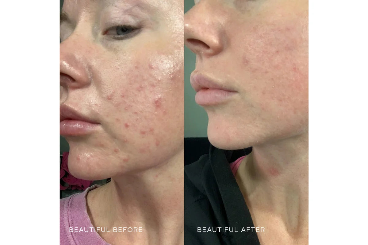 White Willow Purifying Cleansing Gel